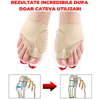 SET 2 CORECTOARE MAGICE PENTRU MONTURI